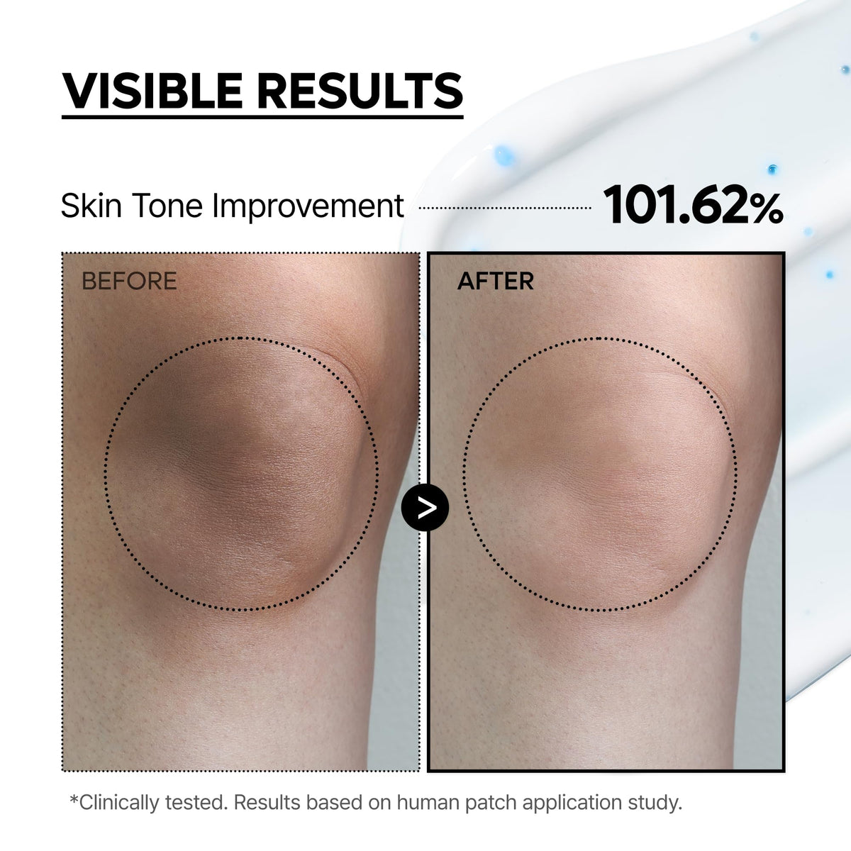 Dr.Melaxin applied to elbow illustrating targeted brightening