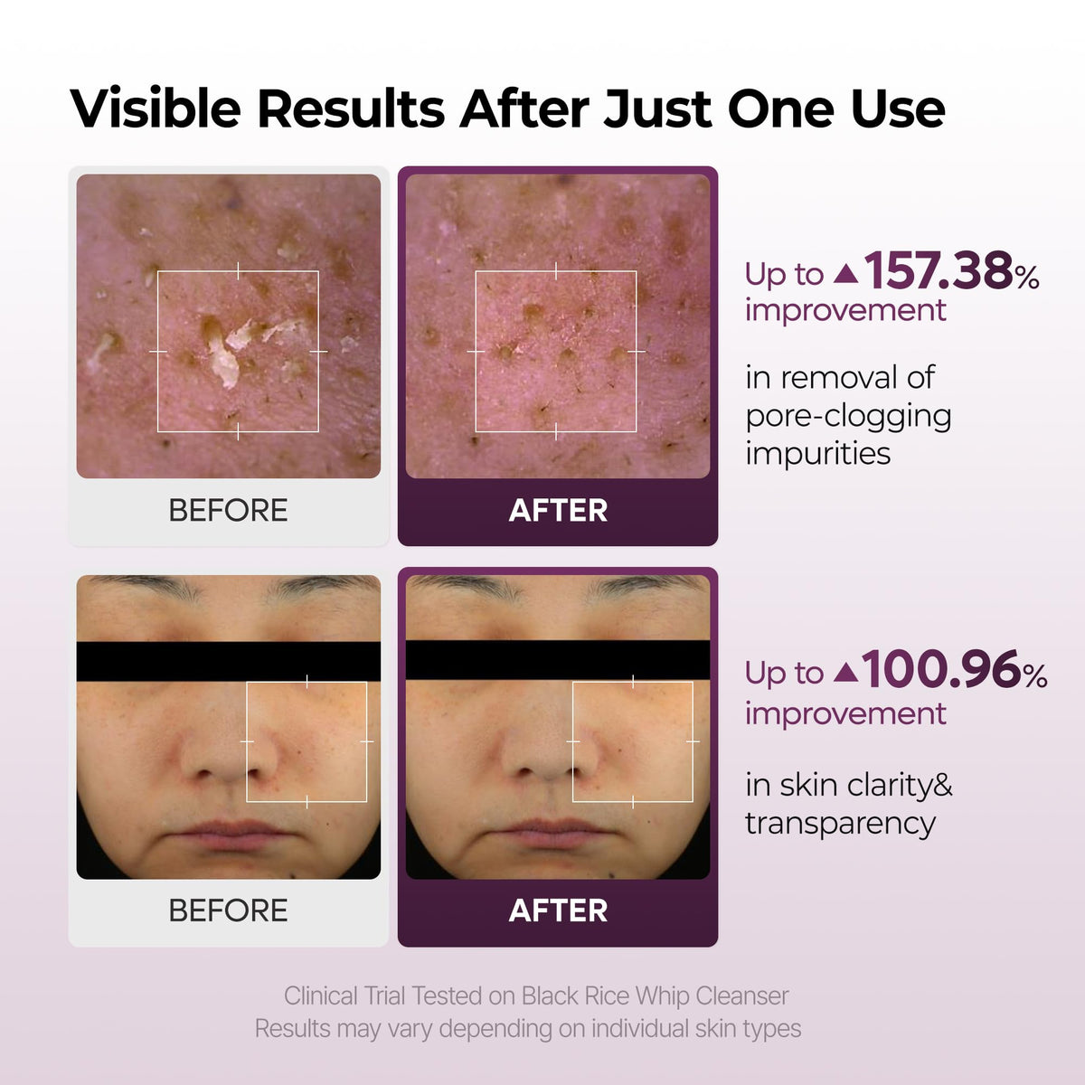 Dr.Melaxin whipped foam in hand demonstrating gentle cushioning effect