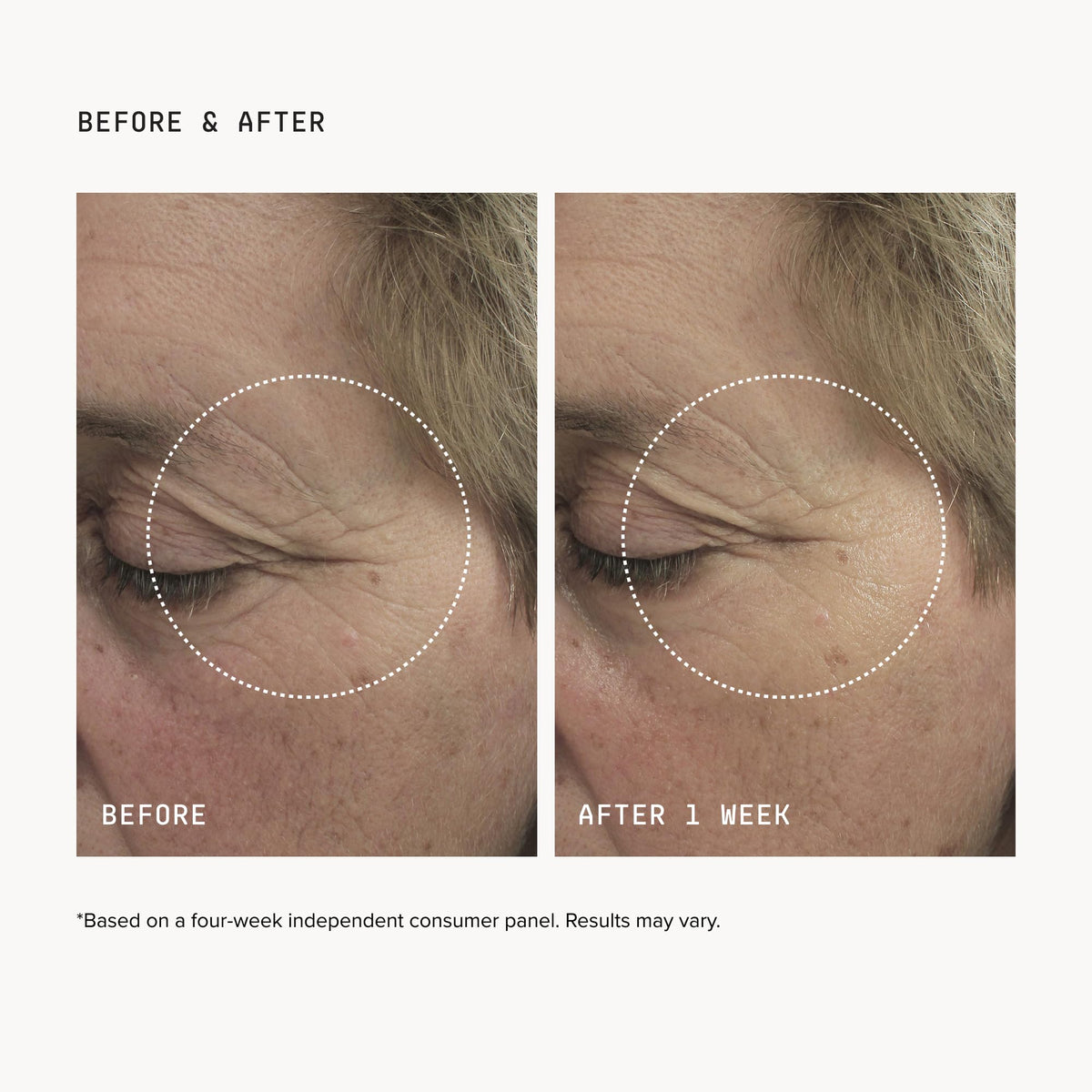 DRMTLGY application under-eye on model demonstrating immediate depuff benefit