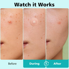 Dr.patch sheet displaying four sizes emphasizing choice and precise coverage