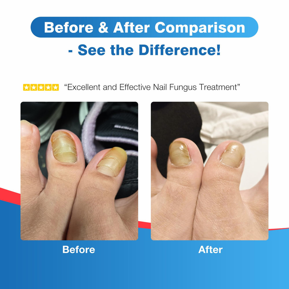 DR.RAPID formula on nail close detail demonstrating quick-dry finish