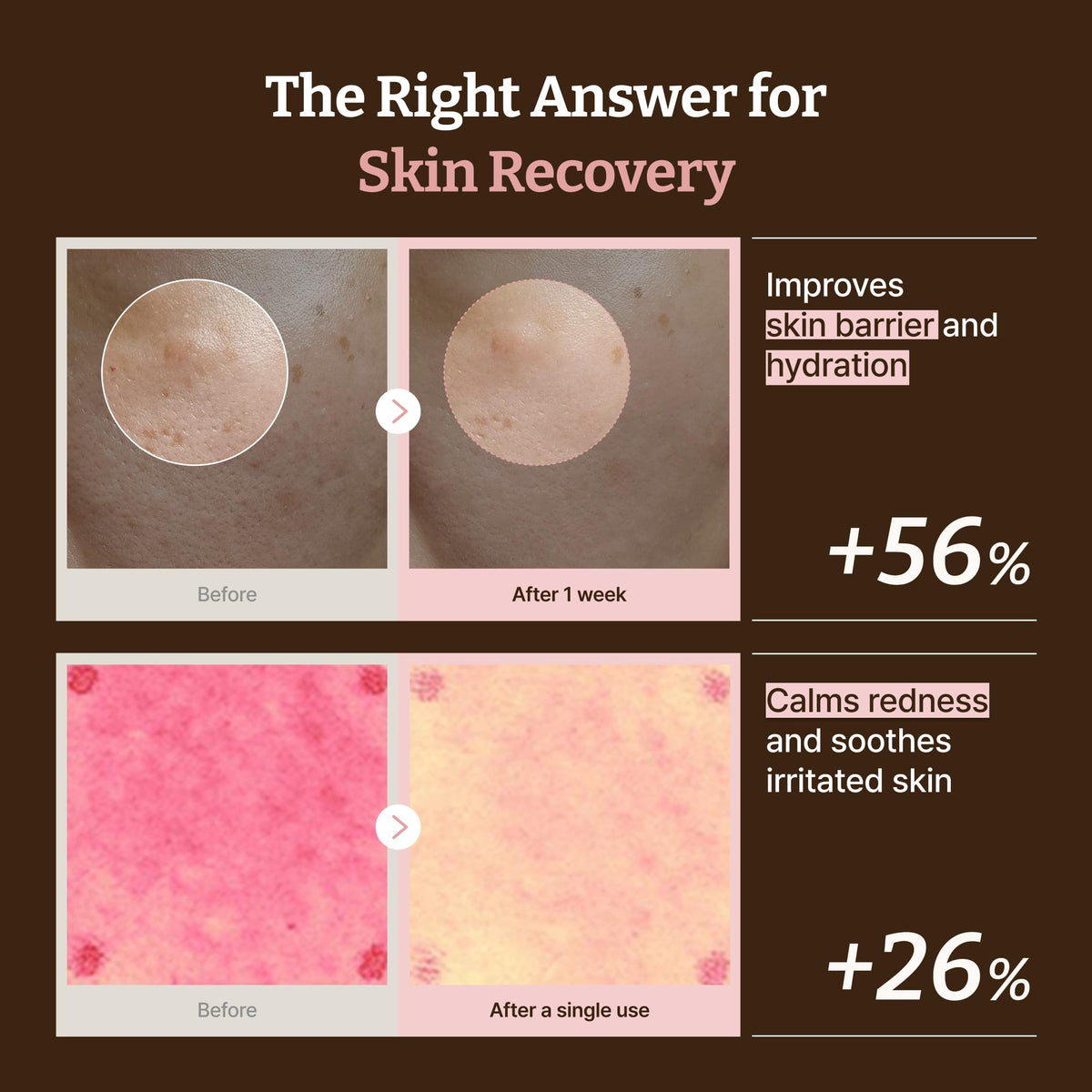 Dr.Reju-All cream on skin during application demonstrating quick absorption