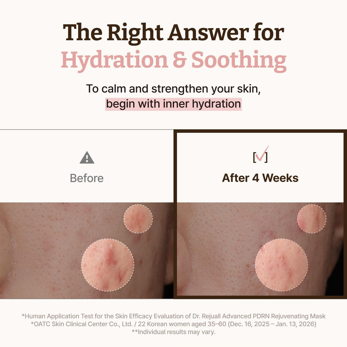 Dr.Reju-All jelly-like serum texture on fingertip for hydrating, non-greasy finish
