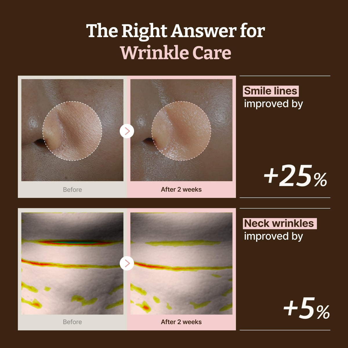 Dr.Reju-All close view of neck sheet contours for targeted coverage and comfort