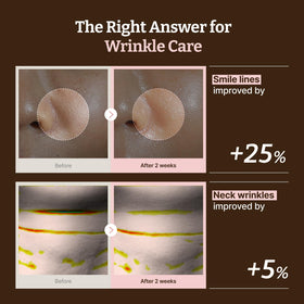 Dr.Reju-All close view of neck sheet contours for targeted coverage and comfort