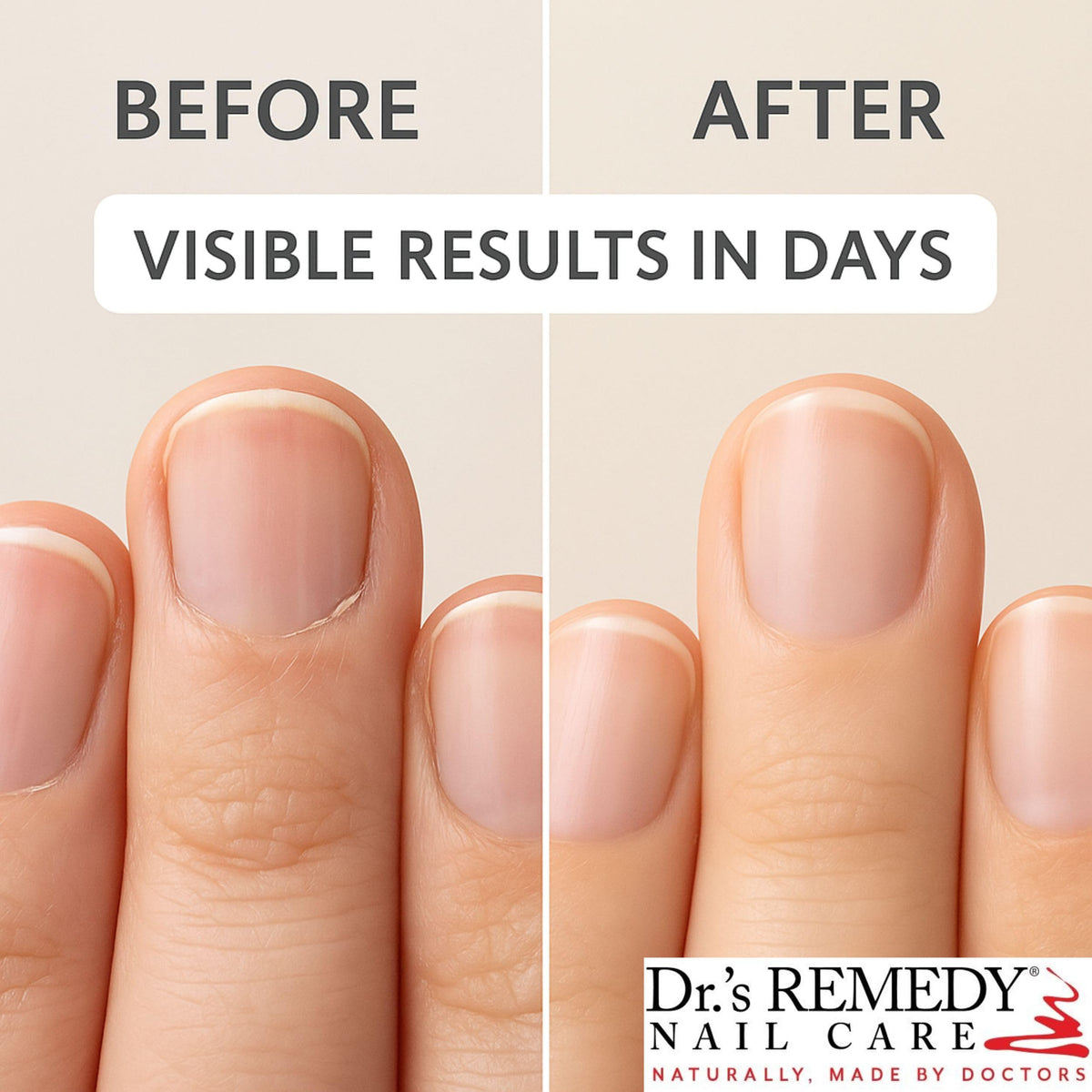 Dr.'s Remedy bottle in hand demonstrating the convenient travel size