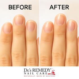 Dr.'s Remedy closeup of clear glossy texture highlighting shine and fast dry