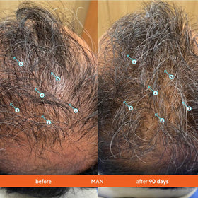 DS Laboratories foam lather on hair demonstrating effective cleanse