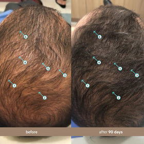 Model applying DS Laboratories serum to scalp demonstrating targeted daily use and ease
