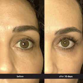 DS Laboratories applying serum along upper lash line demonstrating easy daily routine