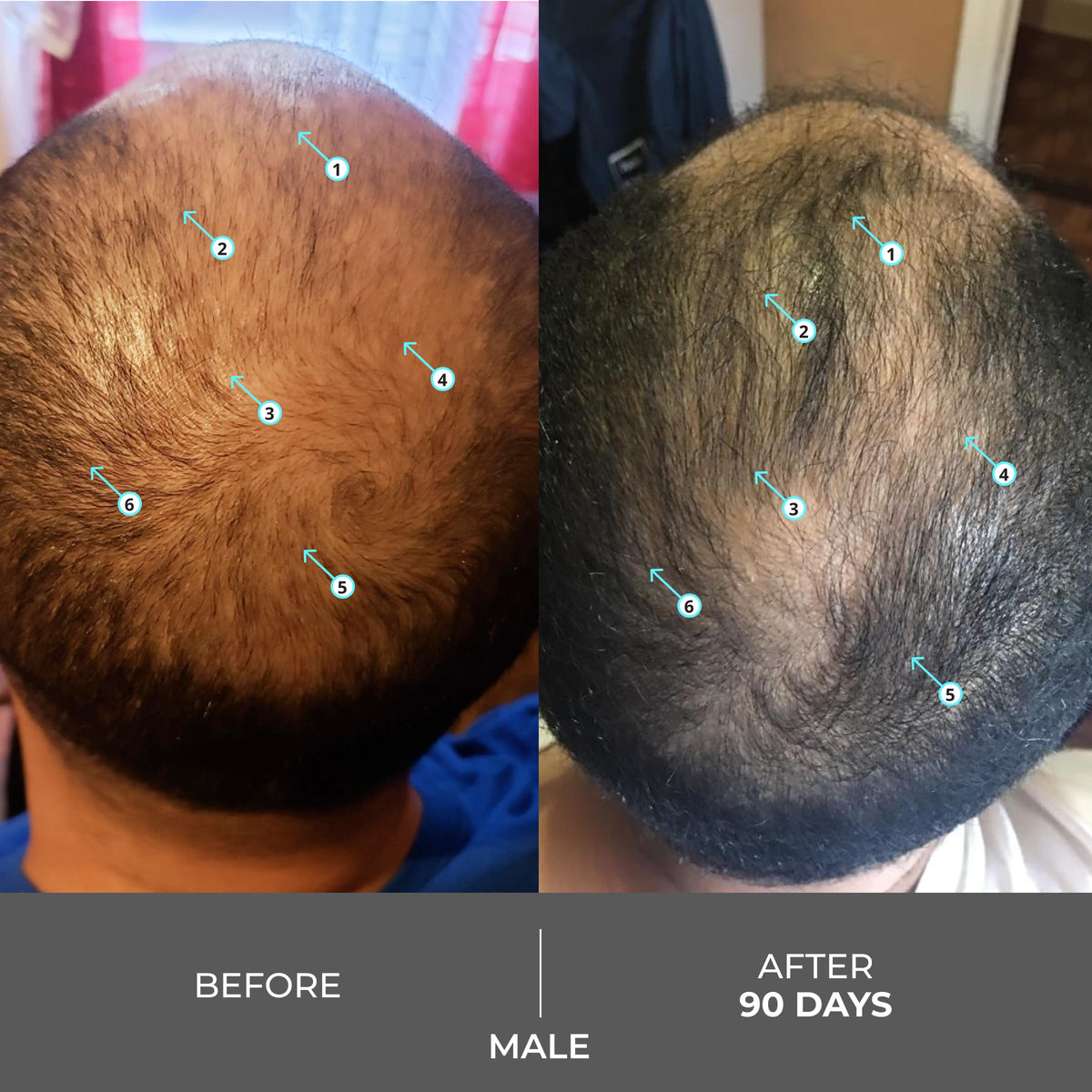 DS Laboratories Revita in-shower use demonstrating scalp-first cleansing action