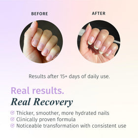 duri brush and cap detail demonstrating precise application benefit