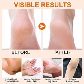 Dvoevivh applying stick to heel for targeted deep hydration