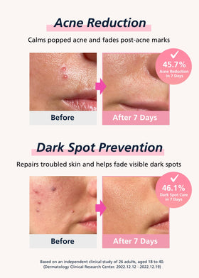 DWEasyDerm patch applied on cheek in lifestyle shot, discreet protection