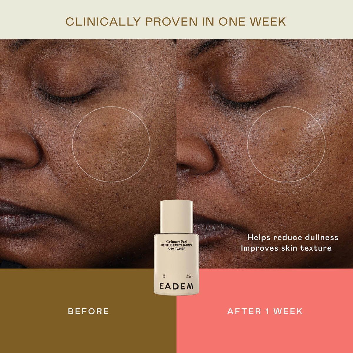 EADEM label close-up listing acids and rice water, clarifying active ingredients and benefits