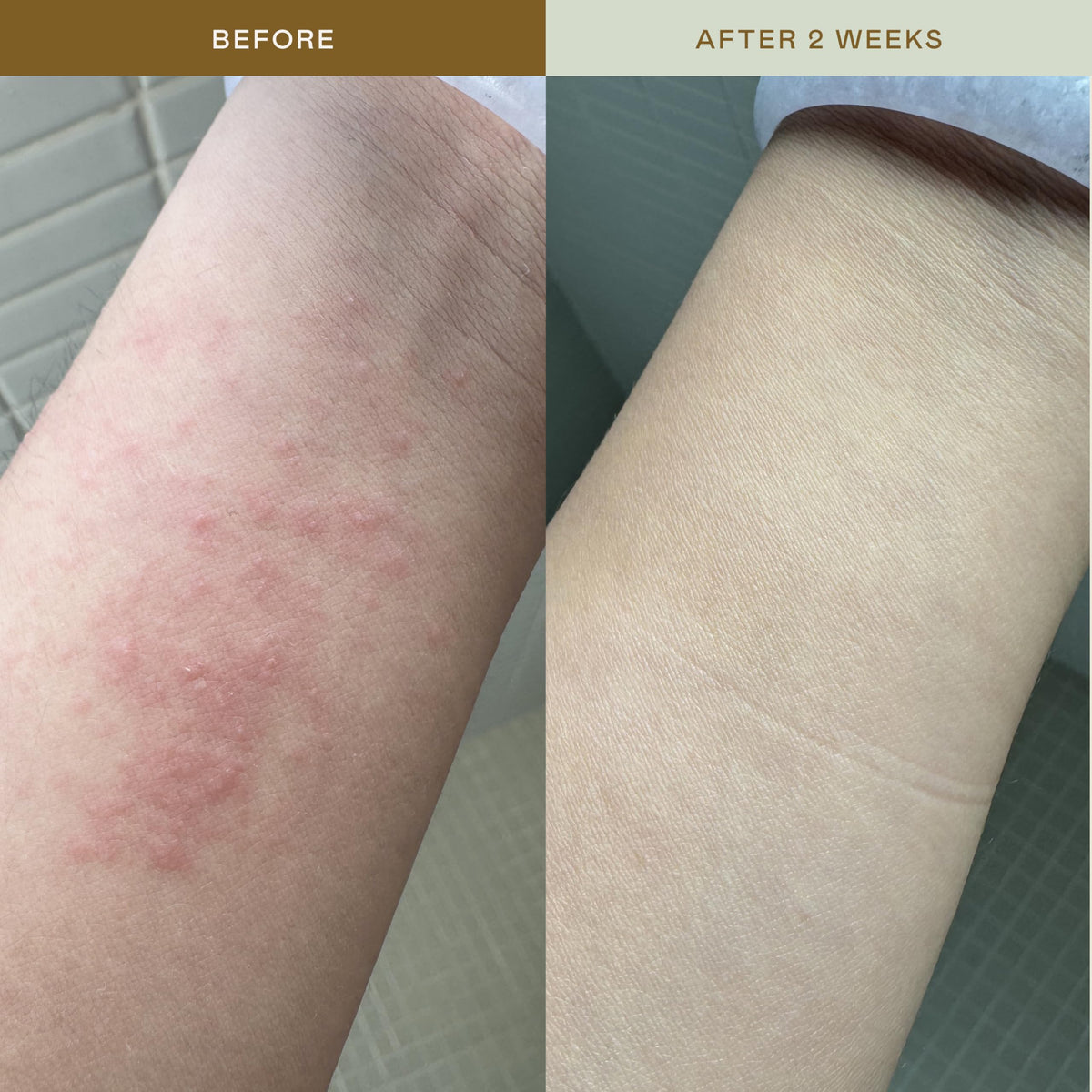 EADEM ingredient close-up with cica illustrating soothing benefit