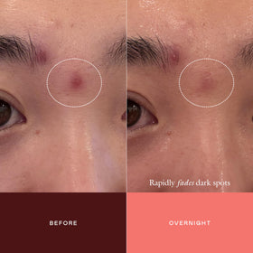 EADEM product applied directly to a dark spot showing targeted coverage benefit