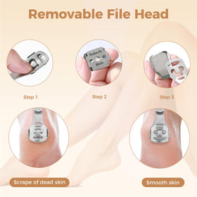 Easkep file in use on heel demonstrating controlled callus reduction