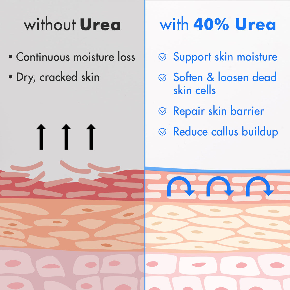 Ebanel before and after callus comparison showing smoother skin