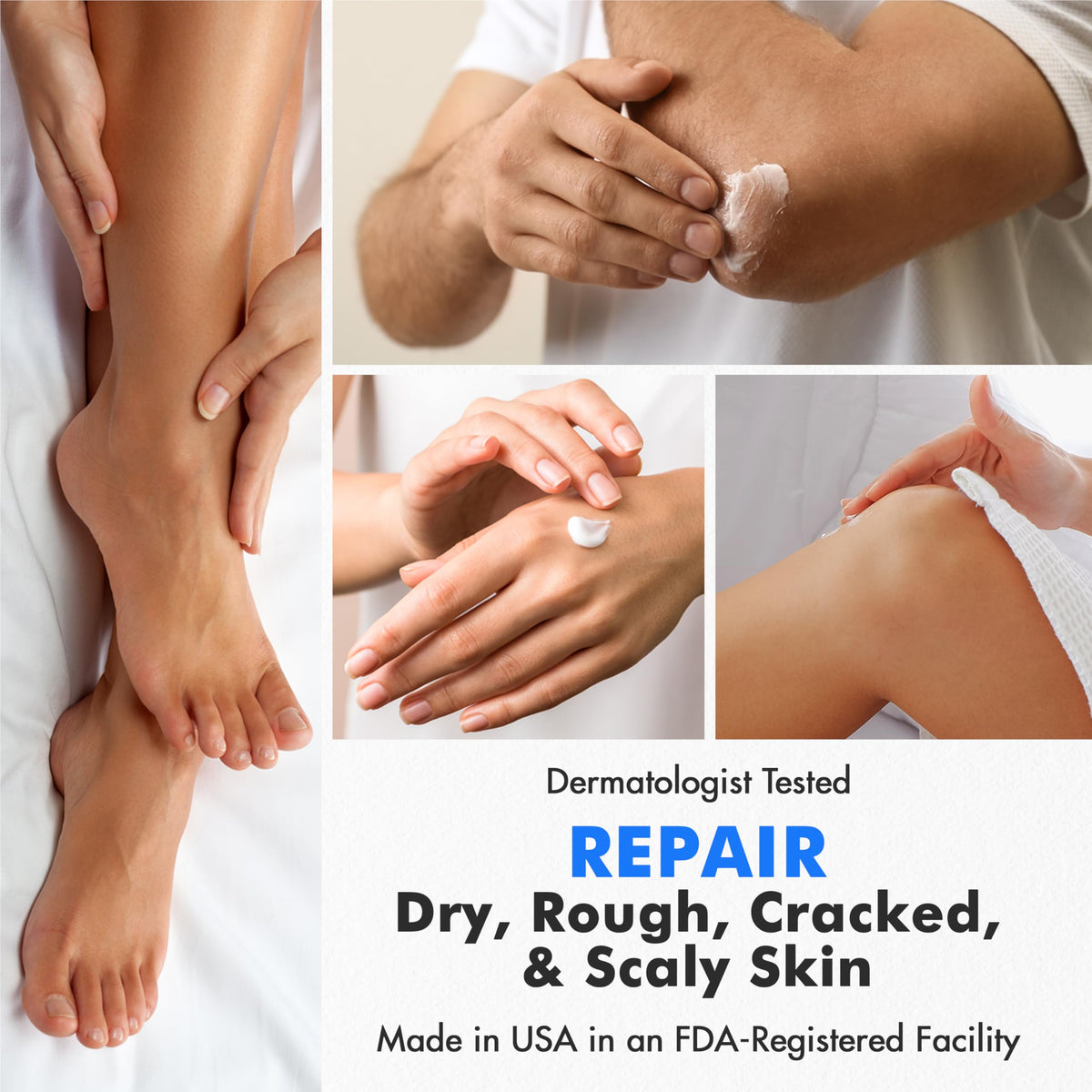 Before and after feet comparison showing Ebanel results and smoother skin