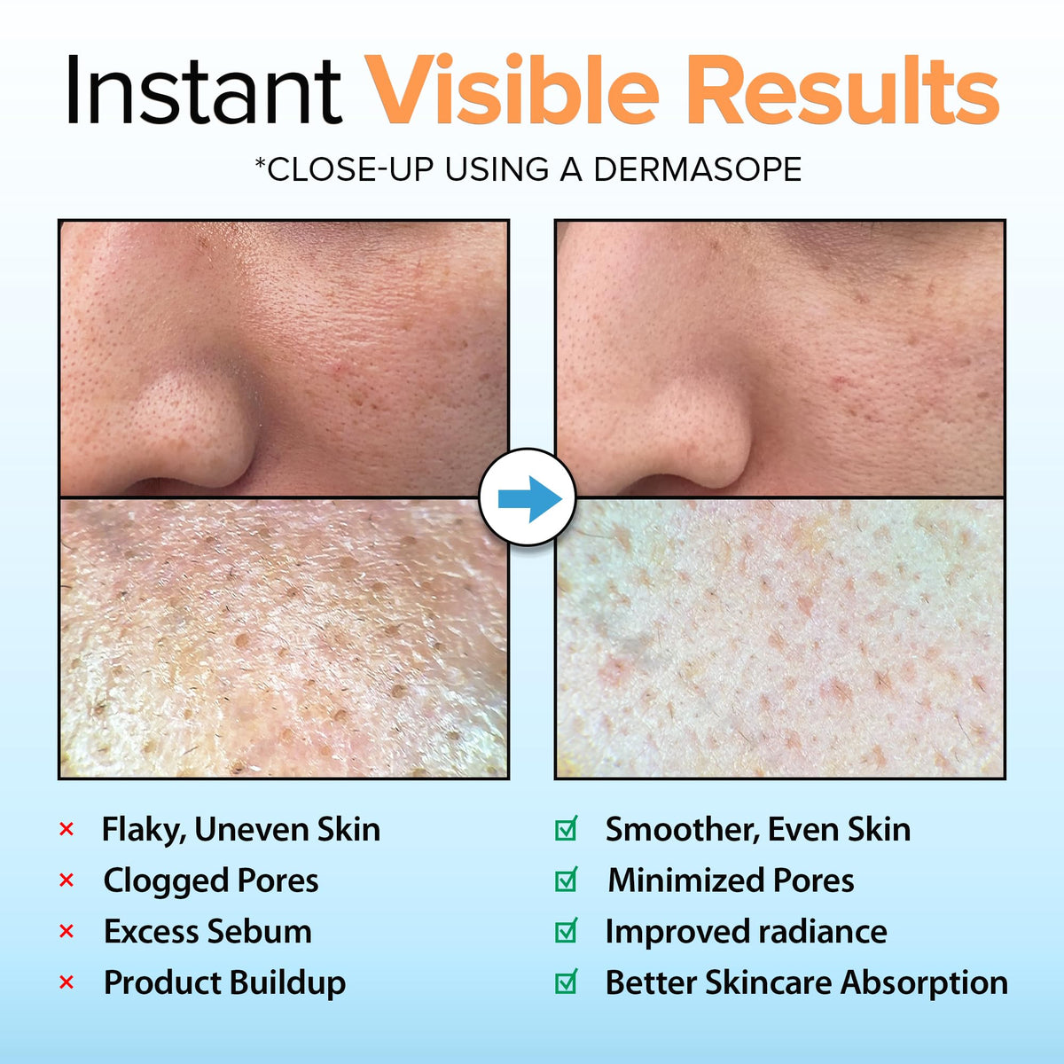 Ebanel ingredient mix with rice bran, papaya, and hyaluronic acid benefits