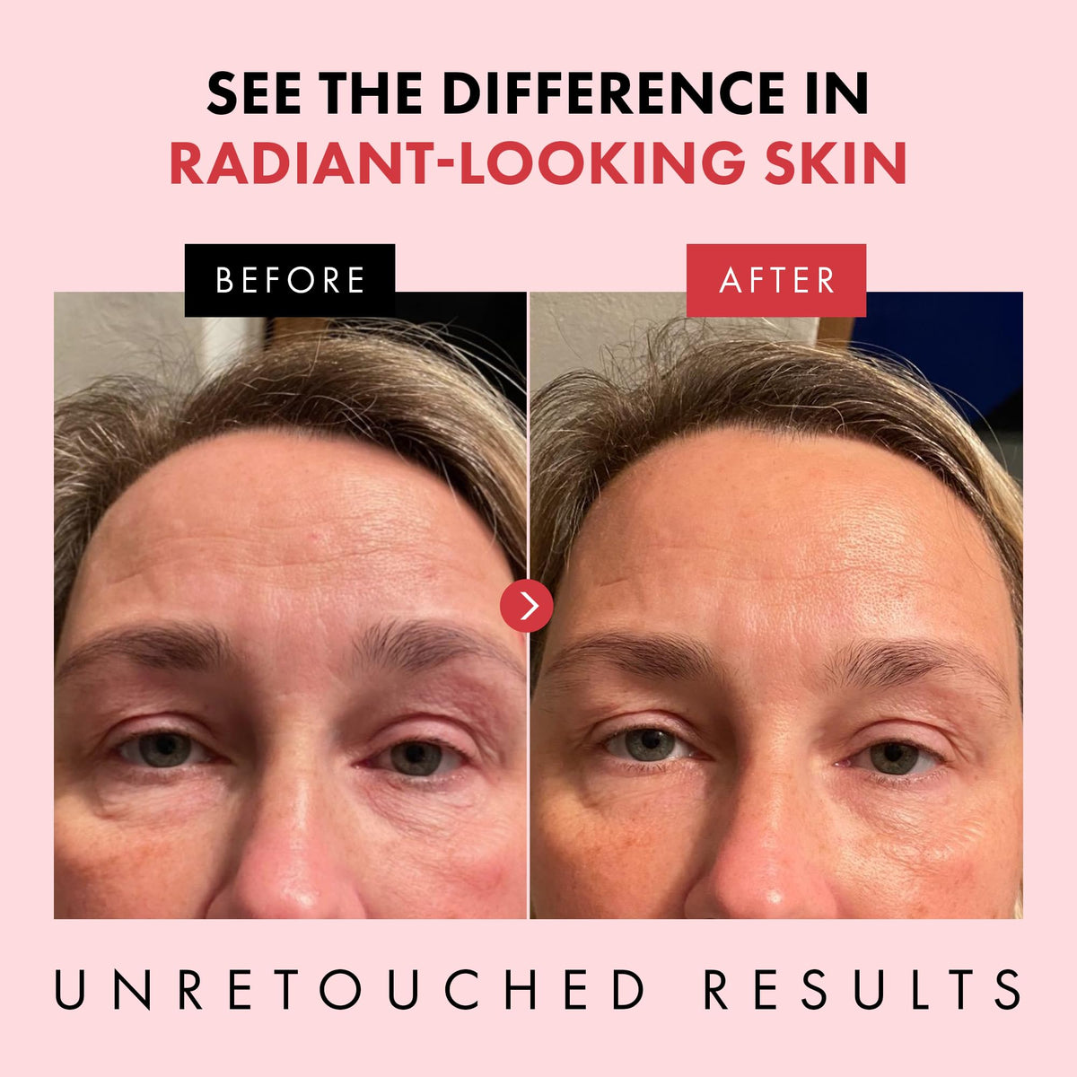 Eclat Skincare dispensing pump showing controlled retinol release for gentler use