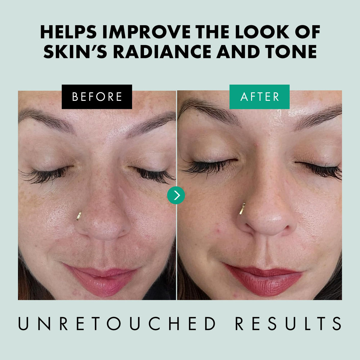 Eclat Skincare ingredient label highlighting niacinamide, zinc PCA and hyaluronic acid benefits