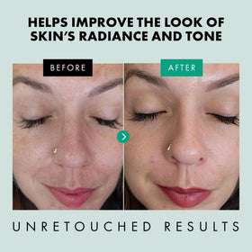 Eclat Skincare ingredient label highlighting niacinamide, zinc PCA and hyaluronic acid benefits