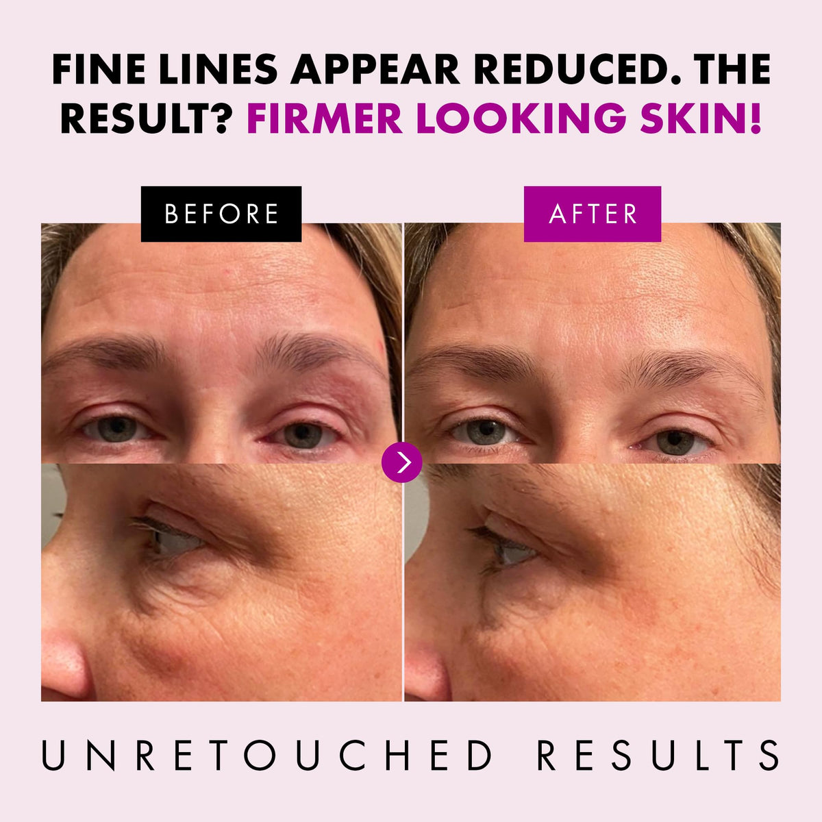 Eclat Skincare peptides and hyaluronic acid ingredient visual benefits