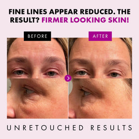 Eclat Skincare peptides and hyaluronic acid ingredient visual benefits