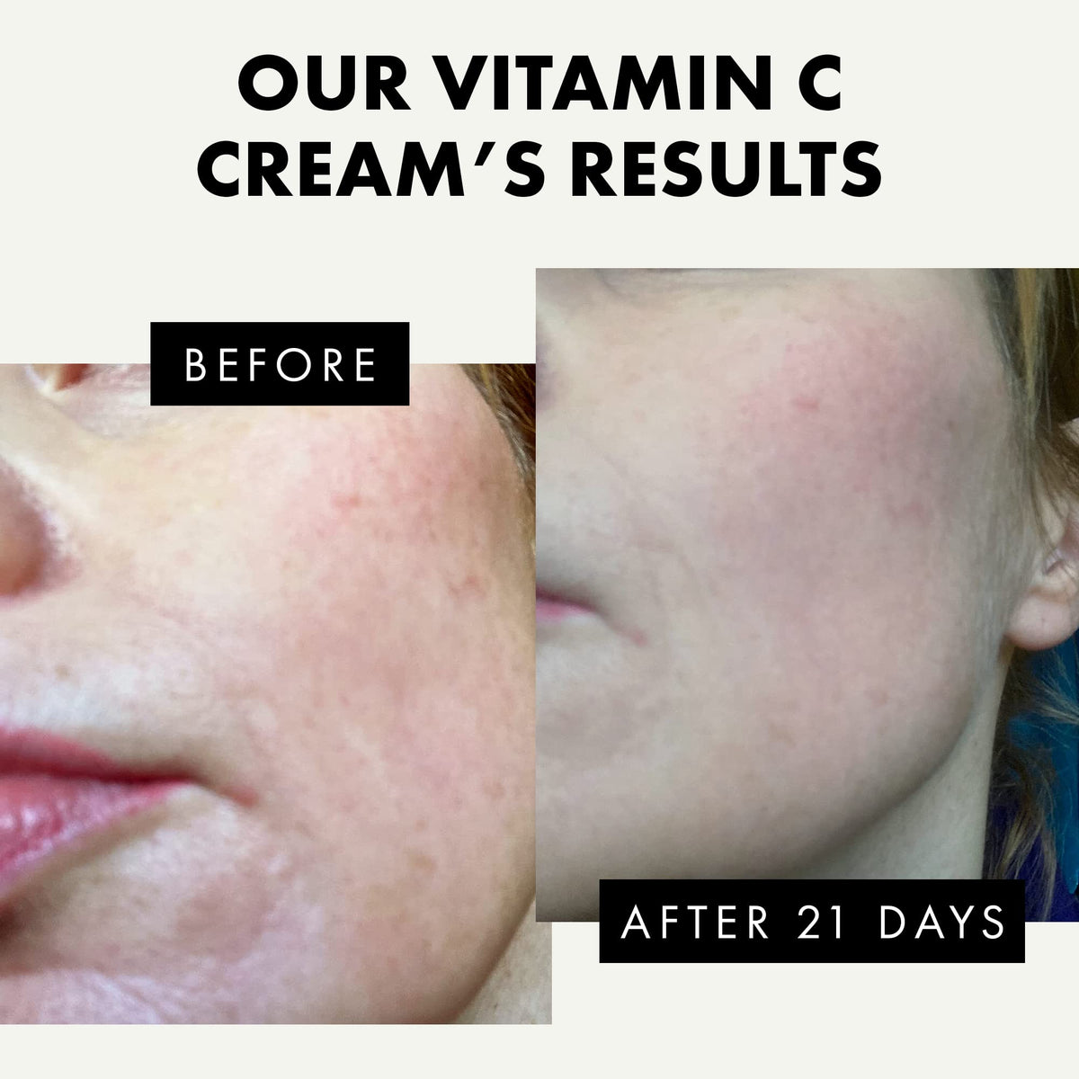 Eclat Skincare in-hand application demonstrating quick absorbency benefit
