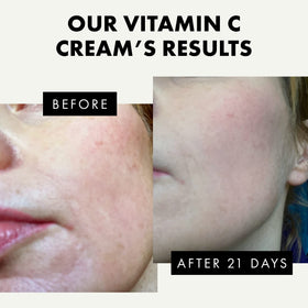 Eclat Skincare in-hand application demonstrating quick absorbency benefit