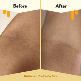ECZEMA HONEY label close-up showing ingredients and gentle formulation benefit