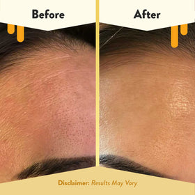 ECZEMA HONEY in-use demo washing face to show gentle cleansing routine