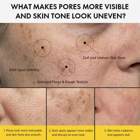 EELHOE before and after on cheek demonstrating refined texture