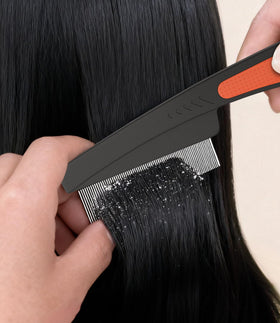 EHBELIF close-up of 2mm standard teeth clearing thick flakes and heavy scalp buildup