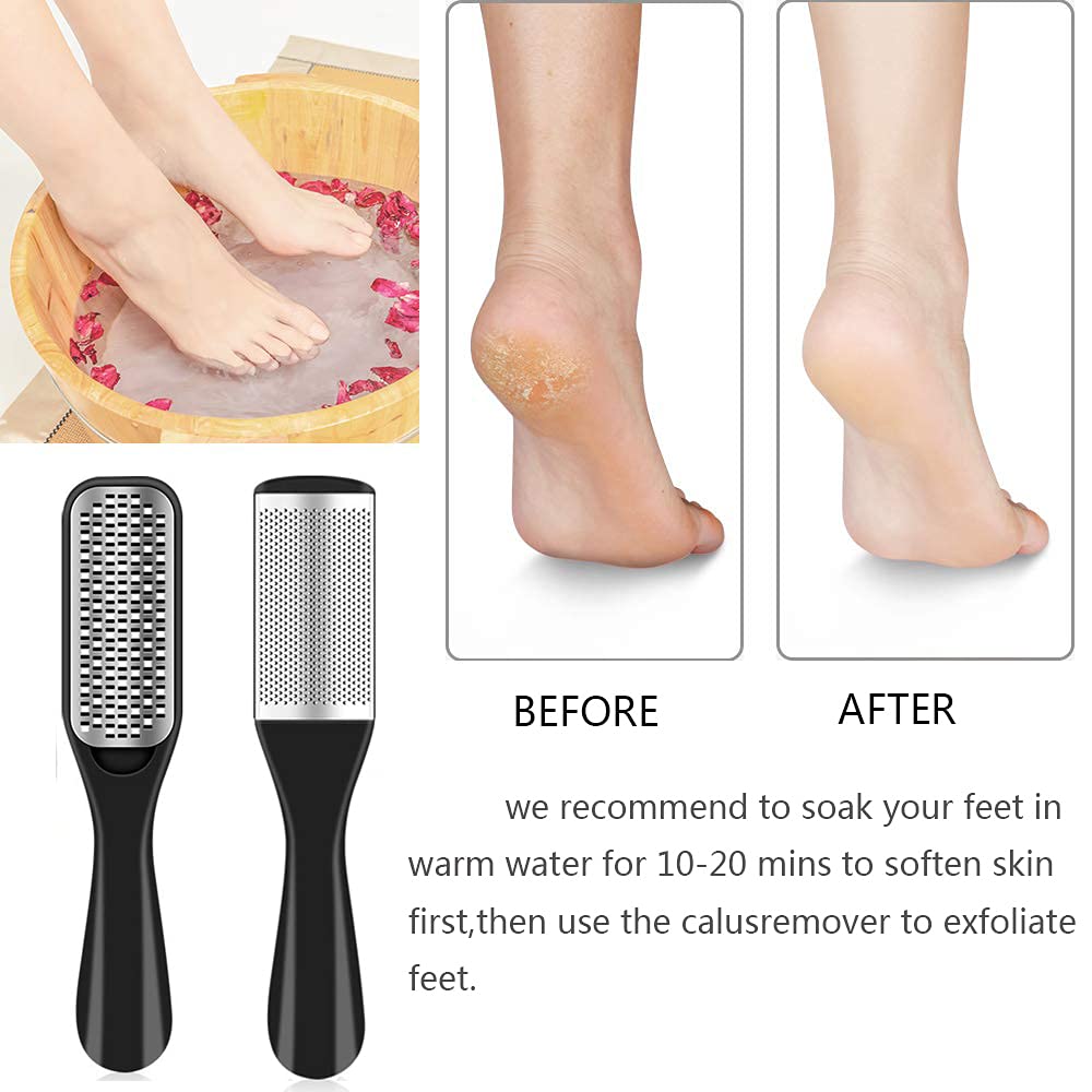 EKOCSIO foot rasp texture detail demonstrating coarse surface for effective callus removal