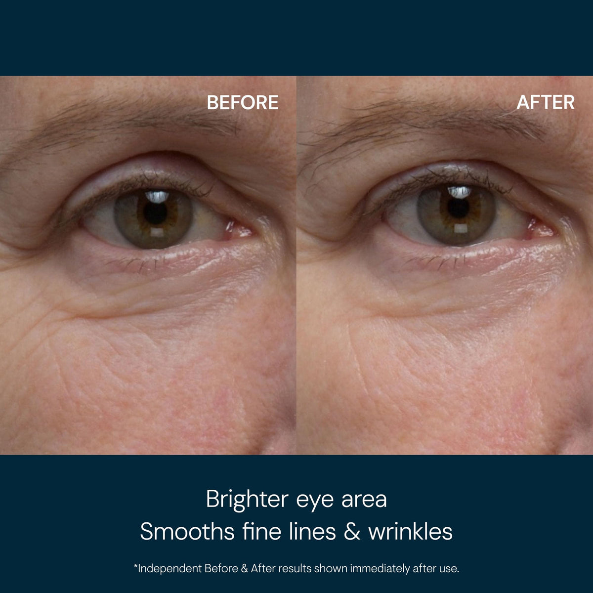 ELEMIS cooling gel texture close-up highlighting lightweight hydration benefit