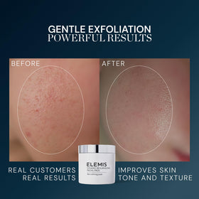 ELEMIS pad soaked with solution showing active lactic acid and enzyme delivery benefit