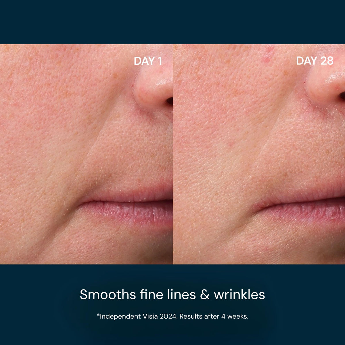 ELEMIS close-up of pump dispensing precise serum for controlled application