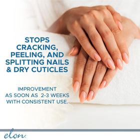 Elon before and after nail comparison showing reduced peeling and smoother growth
