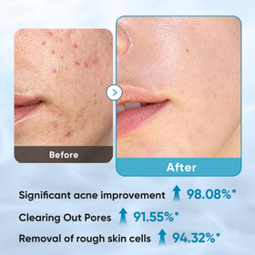Elvira textured side detail demonstrating effective residue removal benefit