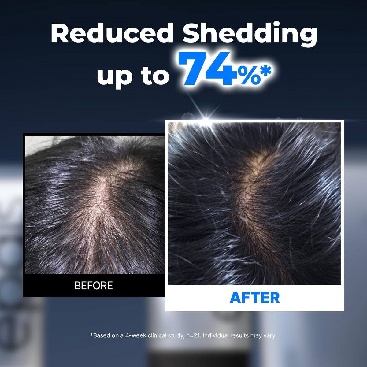 EPAIS 38 brush tips detail highlighting even distribution and gentle massage