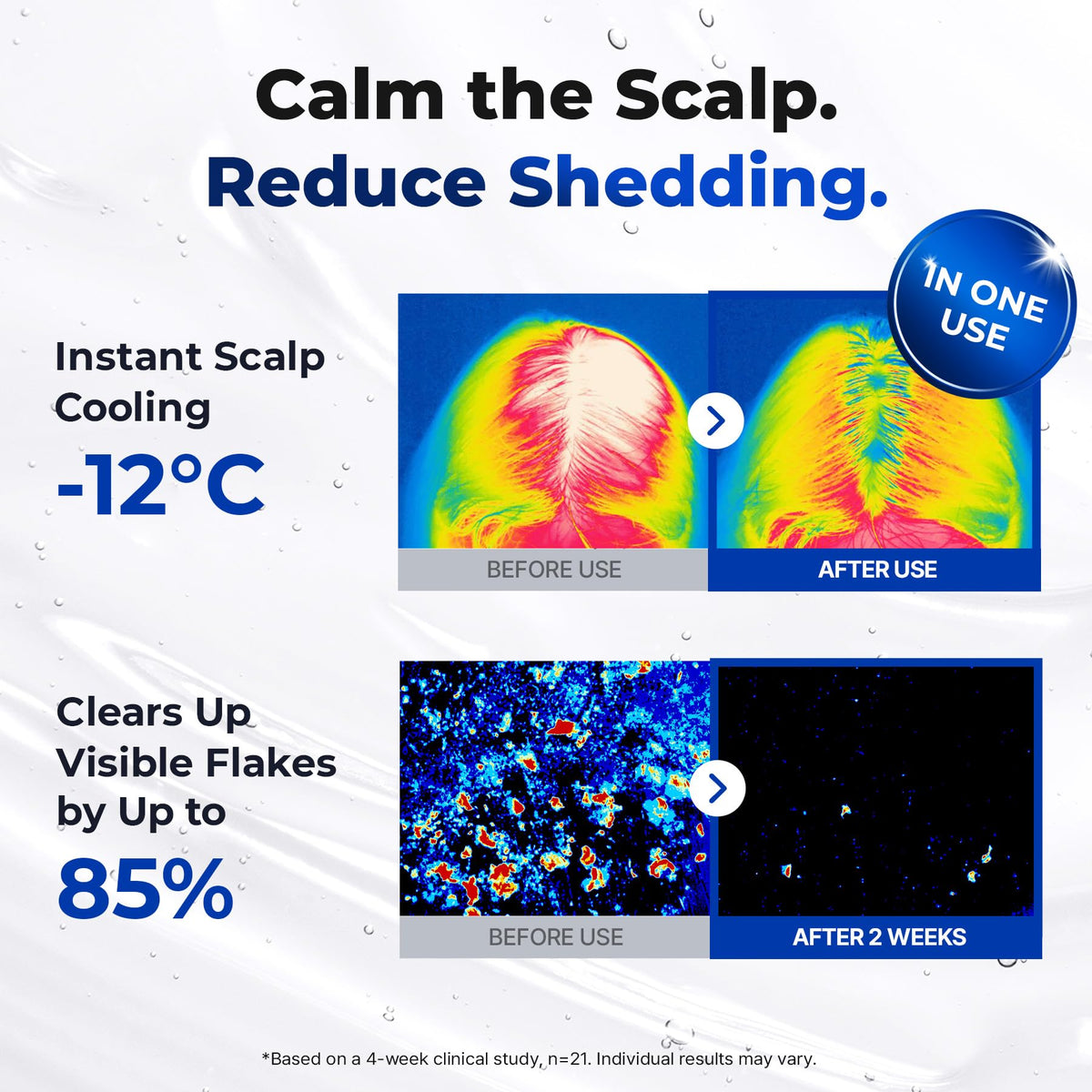EPAIS curved 20° profile illustrating scalp contour fit for precise application