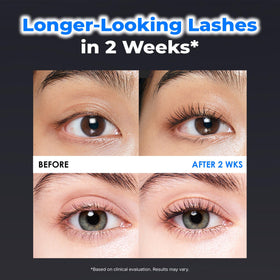 EPAIS ball-tip applicator applying serum at the lash roots