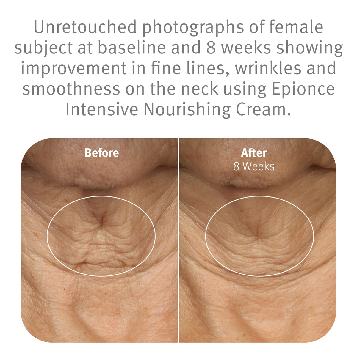 Scoop of Epionce cream on hand demonstrating easy application and immediate smoothing benefit