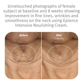 Scoop of Epionce cream on hand demonstrating easy application and immediate smoothing benefit