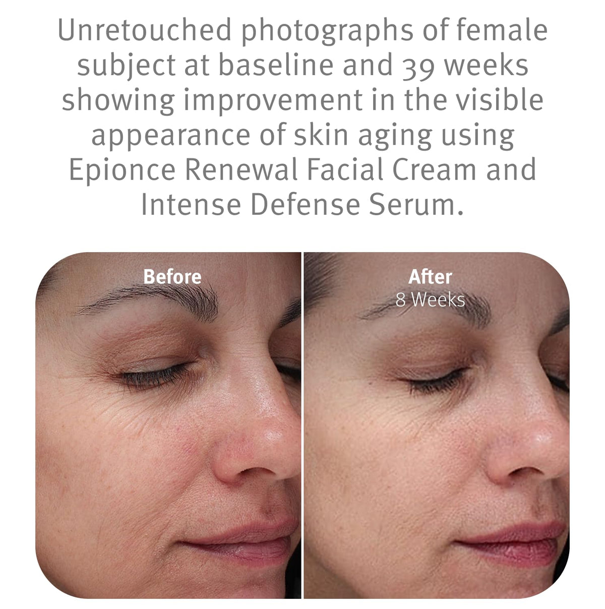 Epionce on model in spa setting showing calming, restorative hydration