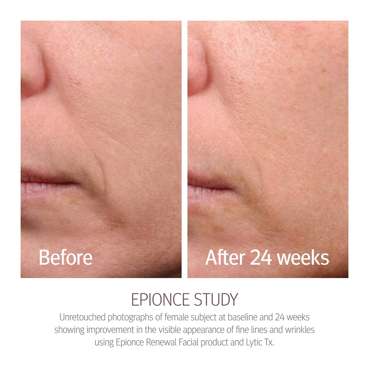 Close-up of Epionce Renewal Facial Lotion texture demonstrating fast-absorbing hydration