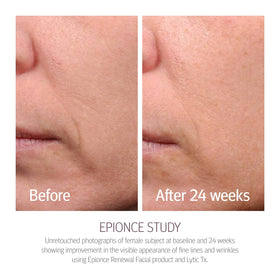 Close-up of Epionce Renewal Facial Lotion texture demonstrating fast-absorbing hydration